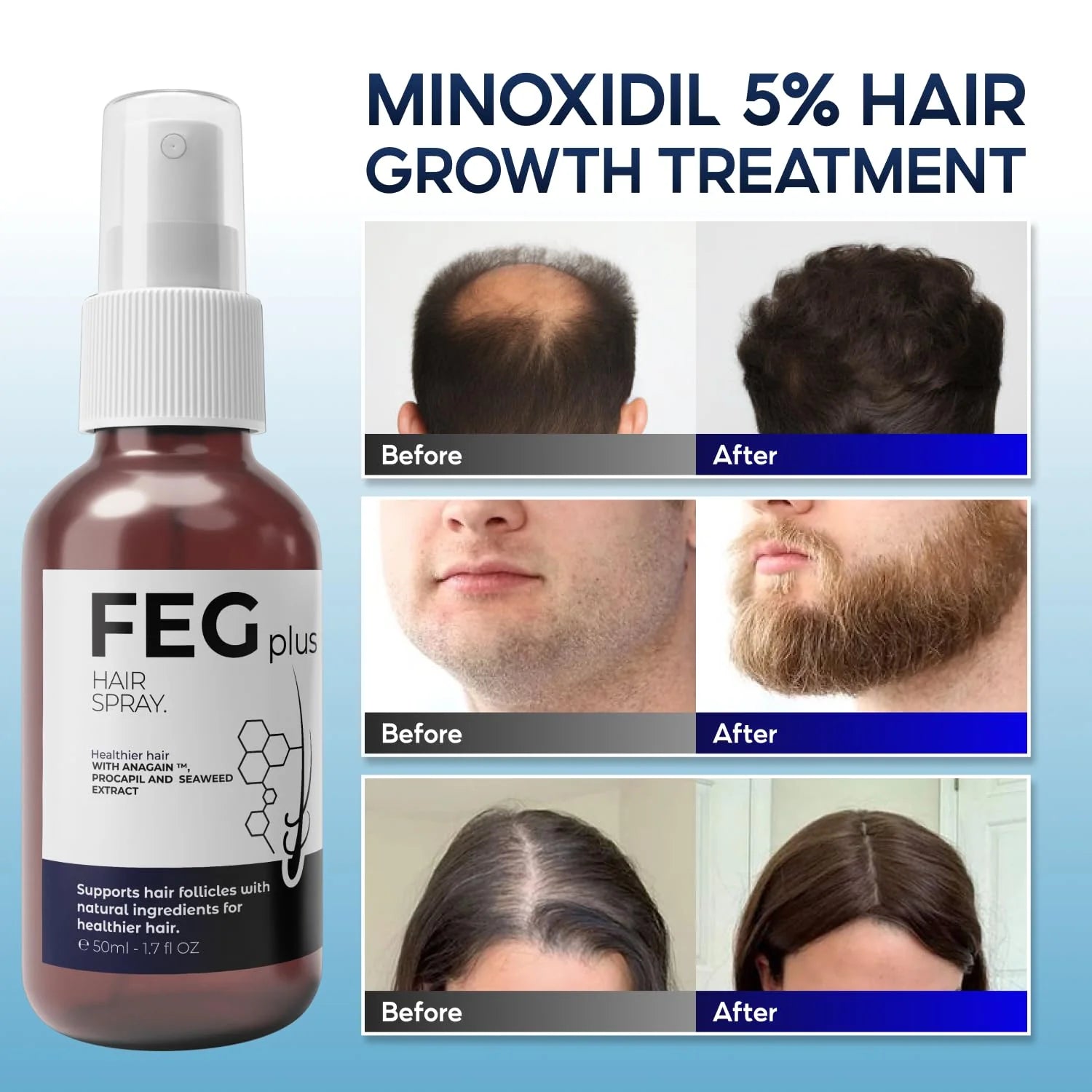 FEG Hair Growth Spray