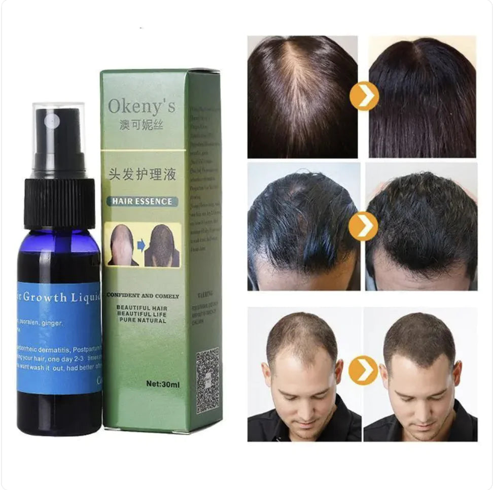 Sunburst Hair Growth Spray & Oil
